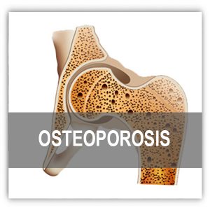 Osteoporosis